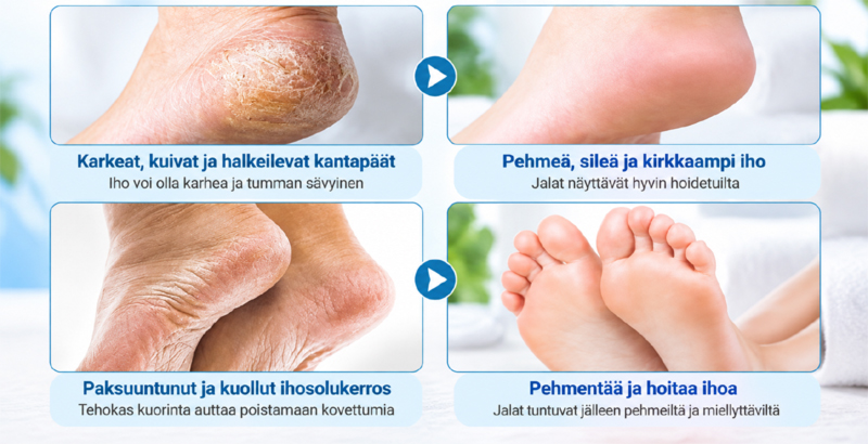 Aloe vera jalkanaamio